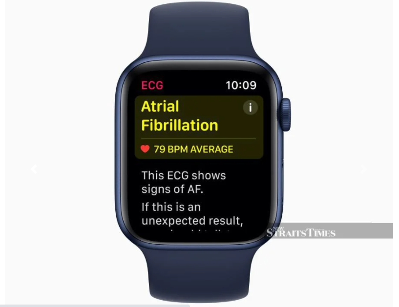 #TECH: ECG feature now available on Apple Watch in Malaysia