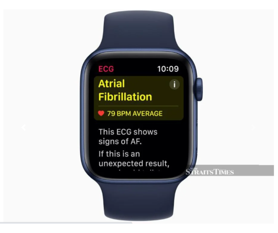 #TECH: ECG feature now available on Apple Watch in Malaysia